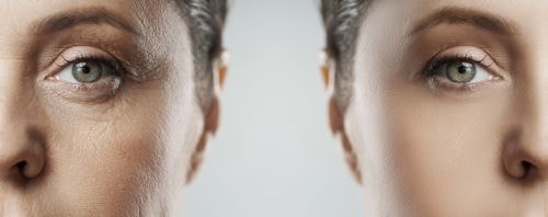 Vorher-Nachher-Bild einer Hautpartie, sichtbar verjüngt und geglättet durch gezielte Anti-Aging-Produkte wie CELLULA+