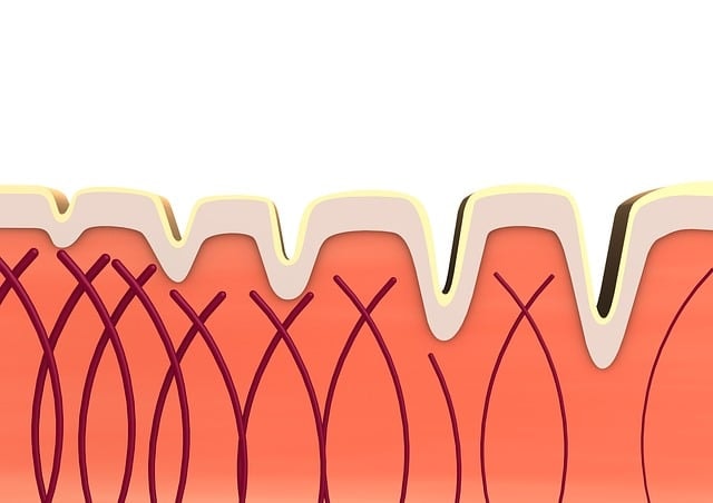 Illustration von Cellulite: Geschwächtes Bindegewebe führt zu Dellenbildung und Orangenhaut